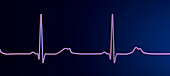 Long QT syndrome type 2 electrocardiogram, illustration