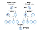 Nondisjunction monosomy x, illustration