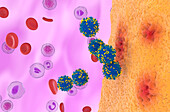 CAR-T cell therapy in rheumatoid arthritis, illustration