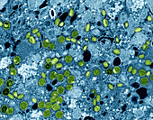 Mpox virus particles, TEM