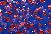 Polycythaemia vera blood cancer, illustration