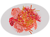 Lewy body molecular structure, illustration