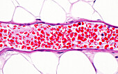 Blood vessel, light micrograph