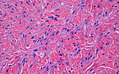 Liver capsule, light micrograph