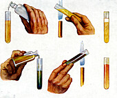 Urinalysis, illustration