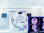 Computed tomography scanner, illustration