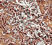 Middle East Respiratory Syndrome, SEM