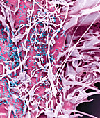 Middle East Respiratory Syndrome, SEM