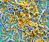 Middle East Respiratory Syndrome, SEM