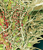 Middle East Respiratory Syndrome, SEM