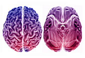 Human brain from above and below, 3D MRI scans
