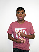 Vitiligo in Addison's disease