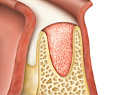 Resorbable collagen matrix over a jaw, illustration