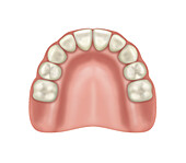 Mildly resorbed upper jaw with teeth, illustration