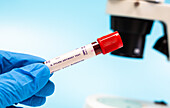 H. pylori antibody blood test