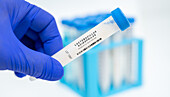 Lactobacillus acidophilus