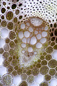 Larkspur (Delphinium sp.) vascular bundle, light micrograph