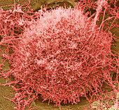 Ebola virus, SEM