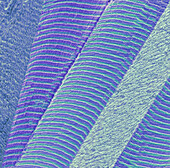 Skeletal muscle, SEM