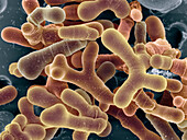Bifidobacterium animalis bacteria, SEM