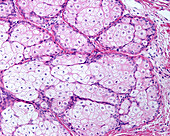 Human sebaceous gland, light micrograph