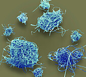 Microplastic pollution, SEM