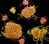 Microplastic pollution, SEM