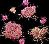 Microplastic pollution, SEM