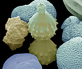 Foraminifera, SEM
