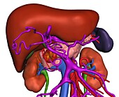 Pancreatic cancer, 3D CT scan