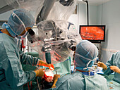 Operation team during a neurosurgical procedure, INI Hanover, Lower Saxony, Germany