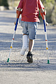 r, Colour, Contemporary, Crutch, Crutches, Daytime, Difficult, Difficulty, Exterior, Fracture, Fractures, Health, Human, Kid, Kids, Leg, Legs, Male, Medical, Medicine, One, One person, Outdoor, Outdoo