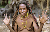 Dani woman with cut fingers as a mourning sign, Baliem valley, Western Papuasia, Former Irian-Jaya, Indonesia