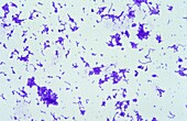 Streptococcus pyogenes bacterium