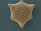 Micrograph of diatom