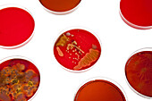 Petri dishes holding different stages of bacteria cultures