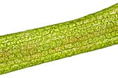 Soft Hornwort (Ceratophyllum submersum) leaf showing chloroplasts and cell walls