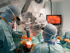 Operationsteam bei einer Gehirnoperation, INI Hannover, Niedersachsen, Deutschland