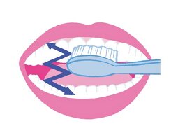 Illustration: Zähne richtig putzen Step 1 von 6
