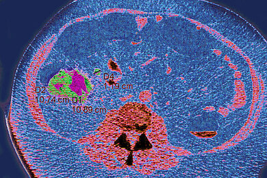 12642019